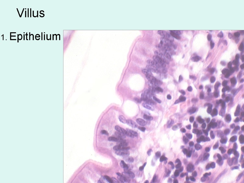 Villus  1. Epithelium